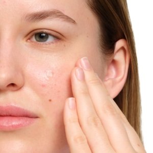 The Ordinary Salicylic Acid 2% Anhydrous Solution 30 ml 03Parapharm - Algérie, Beauté, Santé , Bien-être...
