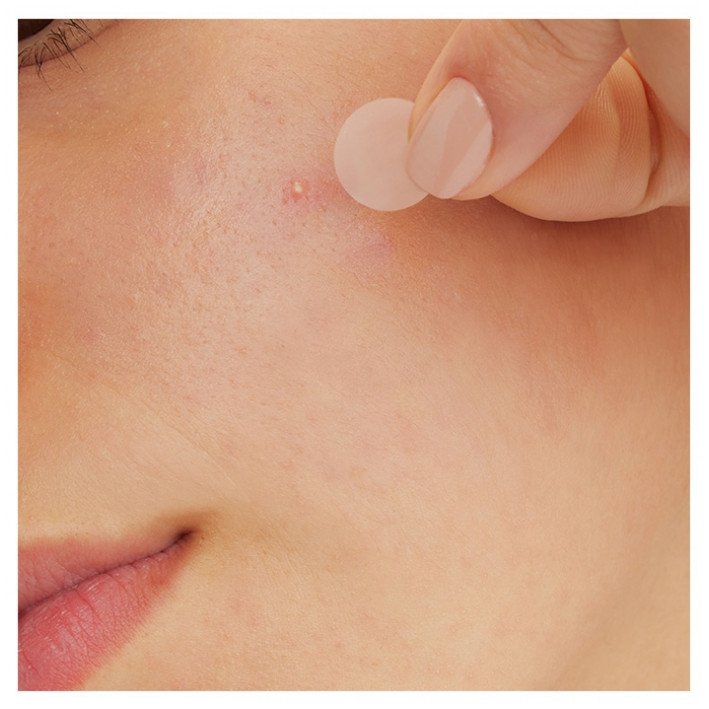 CeraVe Patchs Anti-Imperfections 22 Patchs 03Parapharm - Algérie, Beauté, Santé , Bien-être... CeraVe Patchs Anti-Imperfections 22 Patchs 03Parapharm - Algérie, Beauté, Santé , Bien-être...