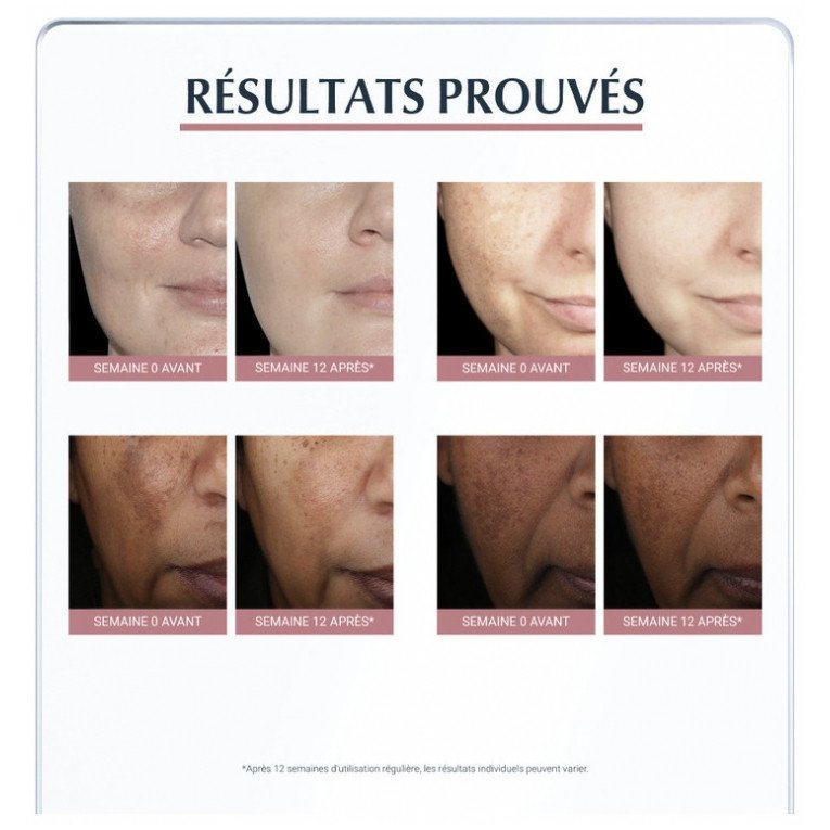 Eucerin Anti-Pigment Correcteur de Taches 5 ml 03Parapharm - Algérie, Beauté, Santé , Bien-être... Eucerin Anti-Pigment Correcteur de Taches 5 ml 03Parapharm - Algérie, Beauté, Santé , Bien-être...