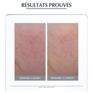 Eucerin Anti Rougeurs Soin Apaisant 50 ml 03Parapharm - Algérie, Beauté, Santé , Bien-être...