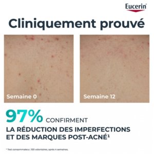 Eucerin DermoPure Clinical Crème Corps Triple Action 200 ml 03Parapharm - Algérie, Beauté, Santé , Bien-être... Eucerin DermoPure Clinical Crème Corps Triple Action 200 ml 03Parapharm - Algérie, Beauté, Santé , Bien-être...