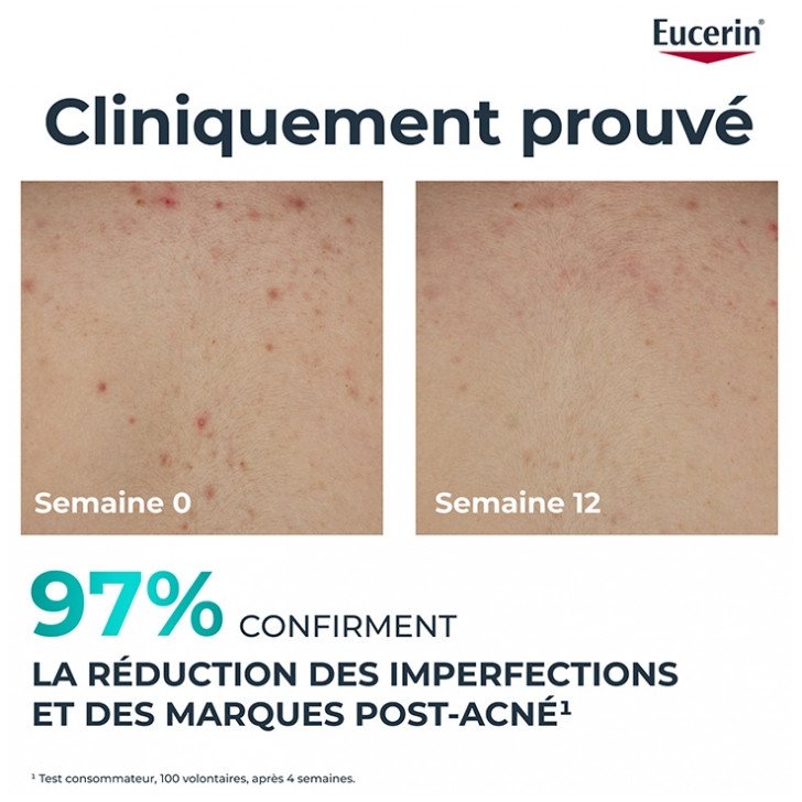 Eucerin DermoPure Clinical Crème Corps Triple Action 200 ml 03Parapharm - Algérie, Beauté, Santé , Bien-être... Eucerin DermoPure Clinical Crème Corps Triple Action 200 ml 03Parapharm - Algérie, Beauté, Santé , Bien-être...