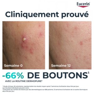 Eucerin DermoPure Sérum Triple Action 40 ml 03Parapharm - Algérie, Beauté, Santé , Bien-être...