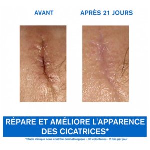 Uriage Bariéderm Cica Crème Réparatrice 100 ml 03Parapharm - Algérie, Beauté, Santé , Bien-être...