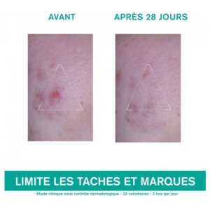 Uriage Hyséac 3-Regul + Soin Global Anti-Imperfections 40 ml 03Parapharm - Algérie, Beauté, Santé , Bien-être... Uriage Hyséac 3-Regul + Soin Global Anti-Imperfections 40 ml 03Parapharm - Algérie, Beauté, Santé , Bien-être...