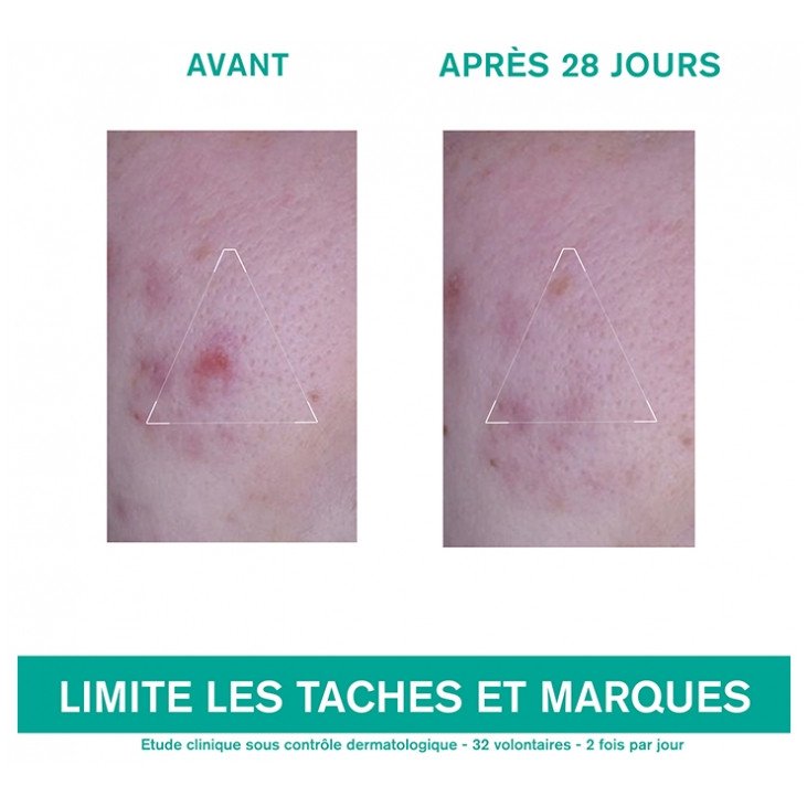 Uriage Hyséac 3-Regul + Soin Global Anti-Imperfections 40 ml 03Parapharm - Algérie, Beauté, Santé , Bien-être... Uriage Hyséac 3-Regul + Soin Global Anti-Imperfections 40 ml 03Parapharm - Algérie, Beauté, Santé , Bien-être...