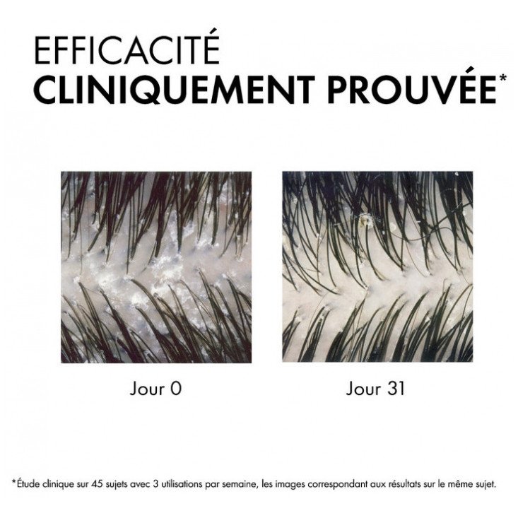 Vichy Dercos Shampoing Traitant Anti-Pelliculaire Cheveux Normaux à Gras 200 ml 03Parapharm - Algérie, Beauté, Santé , Bien-être... Vichy Dercos Shampoing Traitant Anti-Pelliculaire Cheveux Normaux à Gras 200 ml 03Parapharm - Algérie, Beauté, Santé , Bien-être...